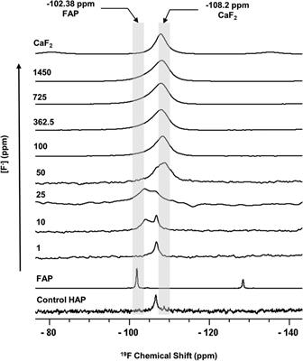 Effects of fluoride on in vitro hydroxyapatite demineralisation analysed by 19F MAS-NMR